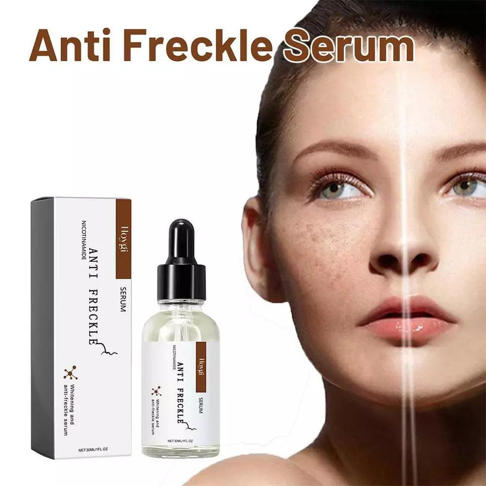 Hoygi Anti Freckle Serum (30ml)